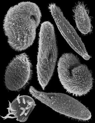  Heterotrichum: ¿Un Ciliado con Cabello Rebelde y una Vida No Tan Simple?