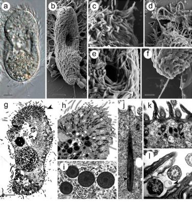  Ichthyophthirius Multifiliis: ¡Un Parasito Ciliado Con Un Nombre Que Te Deja Sin Aliento!